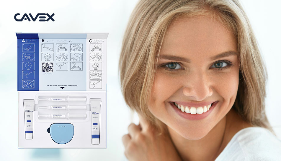 Bleching mit HPS-Gel